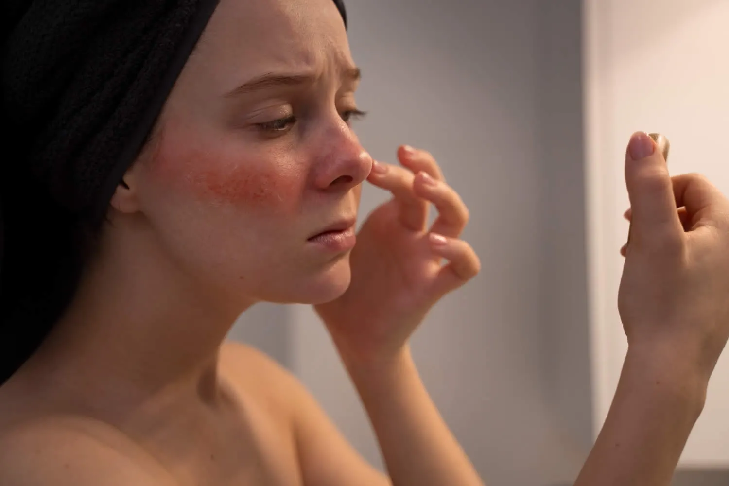 medical dermatology woman woman-looking-her-rosacea-mirror